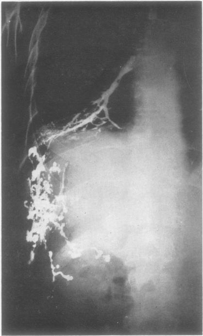 https://cdn.ncbi.nlm.nih.gov/pmc/blobs/a58e/1019236/62248b7f5cde/thorax00046-0024-a.jpg