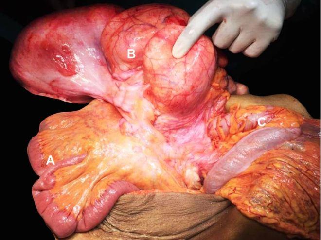 https://cdn.ncbi.nlm.nih.gov/pmc/blobs/a593/6394358/a8c0c5836262/autopsy-09-01e2018056-g02.jpg