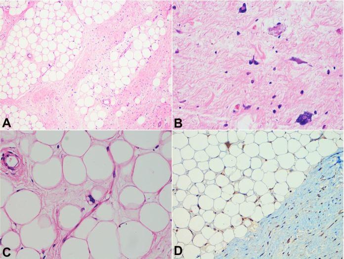 https://cdn.ncbi.nlm.nih.gov/pmc/blobs/a593/6394358/af75b4abcaaf/autopsy-09-01e2018056-g07.jpg