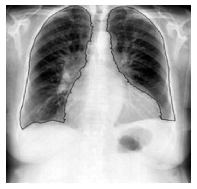 https://cdn.ncbi.nlm.nih.gov/pmc/blobs/a596/6220737/c65ef4315a4b/IJBI2018-9752638.003.jpg