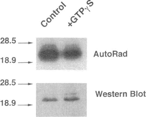 https://cdn.ncbi.nlm.nih.gov/pmc/blobs/a5a2/276079/d4128a5f2d36/mbc00002-0098-a.jpg