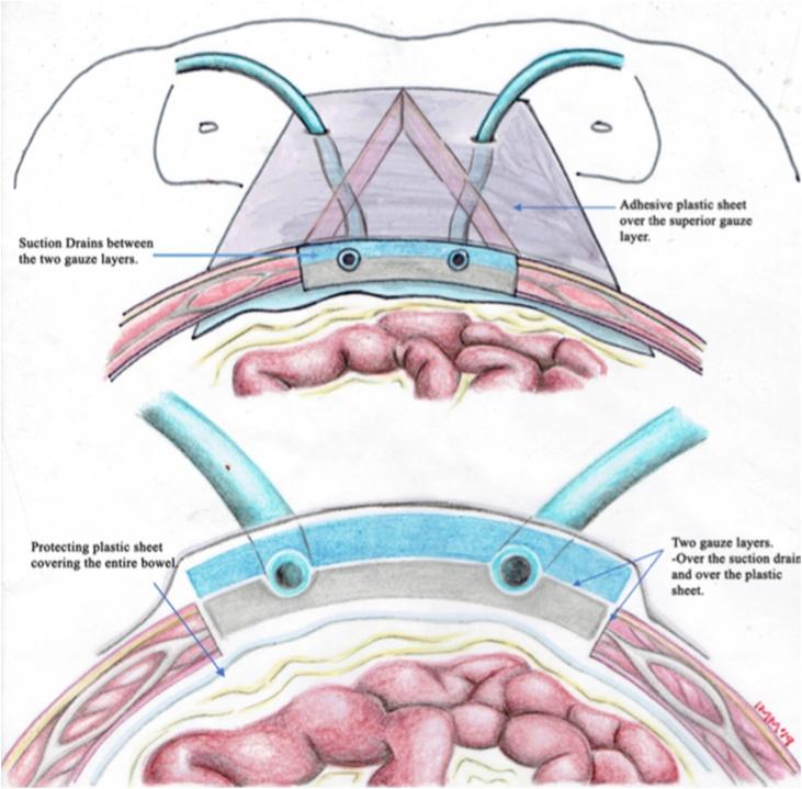 https://cdn.ncbi.nlm.nih.gov/pmc/blobs/a5a4/6677784/fa08683e67e8/gr5.jpg