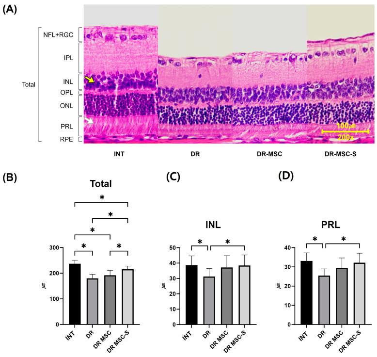 https://cdn.ncbi.nlm.nih.gov/pmc/blobs/a5a7/10886997/7d84080aa9bf/biomedicines-12-00383-g004.jpg