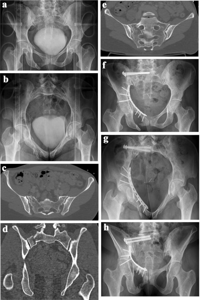 https://cdn.ncbi.nlm.nih.gov/pmc/blobs/a5a7/8629807/3d04e6bda64f/68_2020_1362_Fig4_HTML.jpg