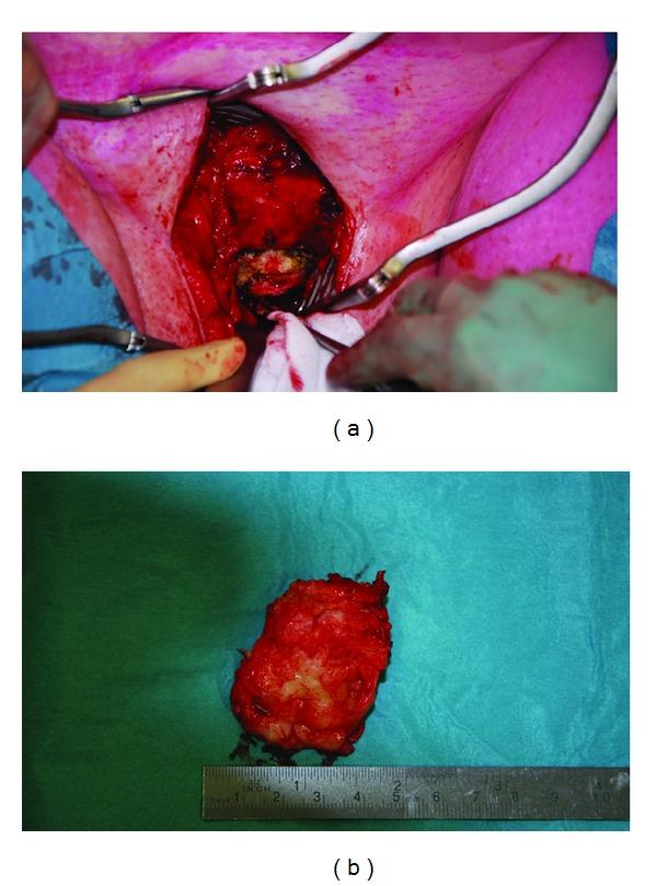 https://cdn.ncbi.nlm.nih.gov/pmc/blobs/a5ac/3914336/6fc059eec529/CRIM.UROLOGY2014-176089.003.jpg