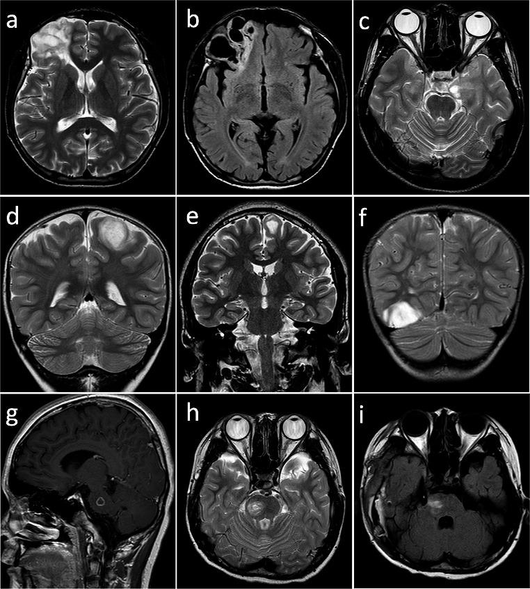 https://cdn.ncbi.nlm.nih.gov/pmc/blobs/a5ae/11698799/9802474d8440/10072_2024_7721_Fig1_HTML.jpg
