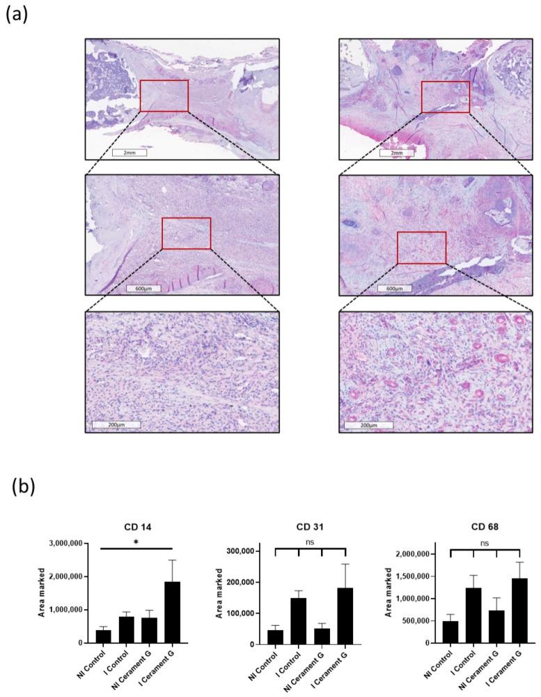 https://cdn.ncbi.nlm.nih.gov/pmc/blobs/a5ae/9599187/537b47df3f25/biomedicines-10-02513-g005.jpg