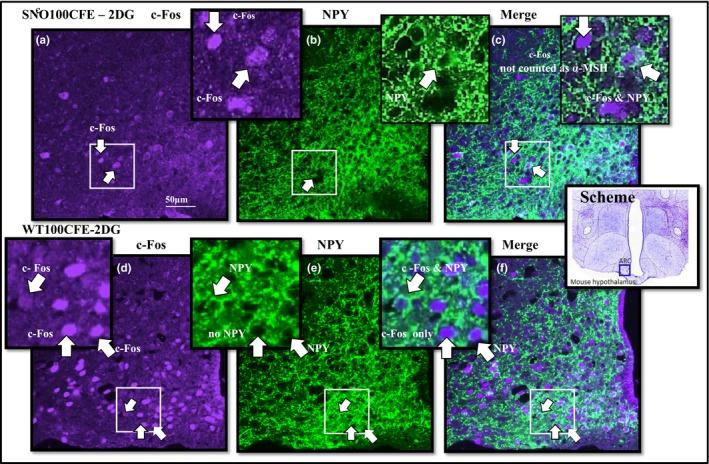 https://cdn.ncbi.nlm.nih.gov/pmc/blobs/a5af/6305914/840785b73448/BRB3-8-e01102-g002.jpg