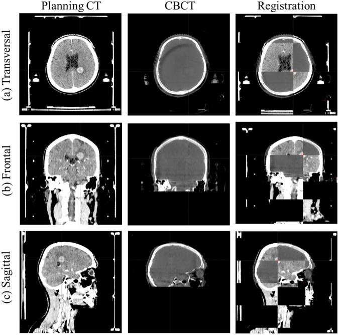 https://cdn.ncbi.nlm.nih.gov/pmc/blobs/a5b0/5438169/edd708653444/pone.0177798.g003.jpg