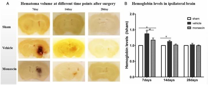 https://cdn.ncbi.nlm.nih.gov/pmc/blobs/a5b0/7232052/3fd94f94b866/10.1177_1756286420921083-fig3.jpg
