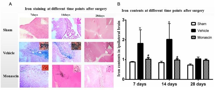https://cdn.ncbi.nlm.nih.gov/pmc/blobs/a5b0/7232052/9f84b2f75f0d/10.1177_1756286420921083-fig4.jpg