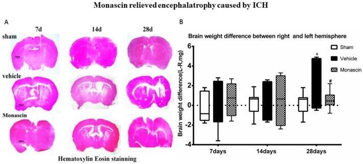 https://cdn.ncbi.nlm.nih.gov/pmc/blobs/a5b0/7232052/e83dceb0f997/10.1177_1756286420921083-fig5.jpg