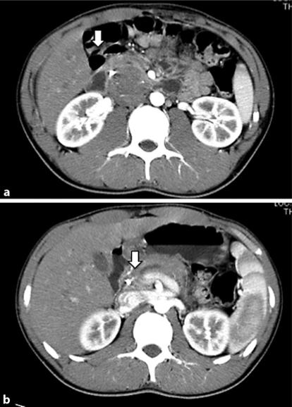 https://cdn.ncbi.nlm.nih.gov/pmc/blobs/a5bd/2988906/e559a3ce1179/crg0004-0104-f01.jpg