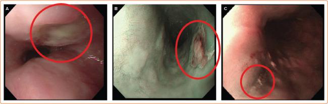 https://cdn.ncbi.nlm.nih.gov/pmc/blobs/a5be/9376833/18b739aa4803/aer-11-e15-g003.jpg