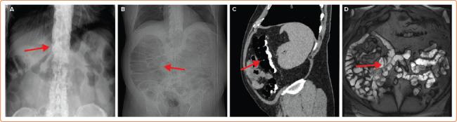https://cdn.ncbi.nlm.nih.gov/pmc/blobs/a5be/9376833/e009d951d46d/aer-11-e15-g004.jpg