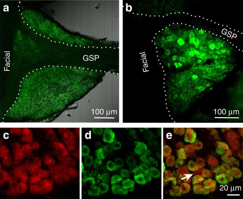 https://cdn.ncbi.nlm.nih.gov/pmc/blobs/a5c7/4595602/d95a0224648f/ncomms9171-f1.jpg