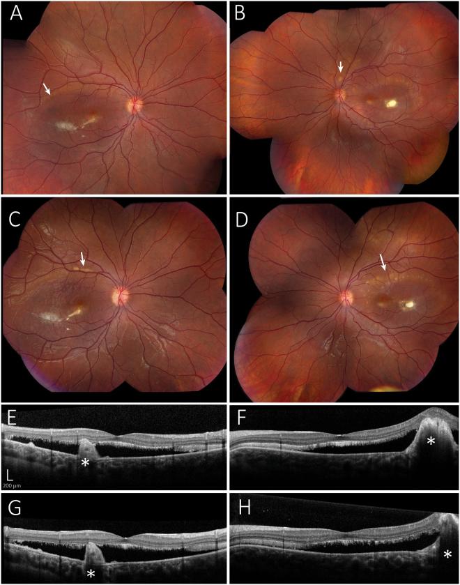 https://cdn.ncbi.nlm.nih.gov/pmc/blobs/a5cd/5852082/fe84aacea2f8/41598_2018_21651_Fig1_HTML.jpg