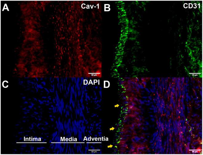 https://cdn.ncbi.nlm.nih.gov/pmc/blobs/a5d2/9086974/0689d67f24d7/fneur-13-796339-g0004.jpg