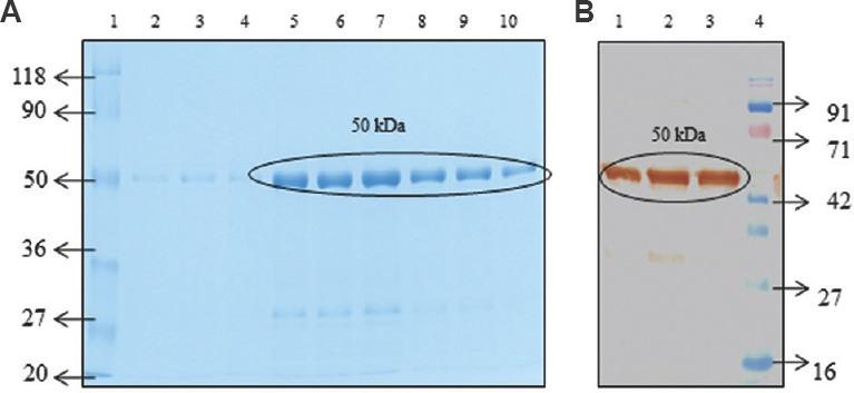 https://cdn.ncbi.nlm.nih.gov/pmc/blobs/a5d3/6118135/54f21599e5e3/IJMR-147-603-g003.jpg