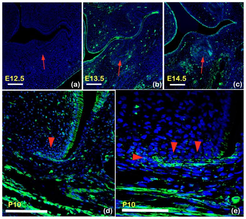 https://cdn.ncbi.nlm.nih.gov/pmc/blobs/a5df/11121487/046ce46459db/ijms-25-05179-g007.jpg