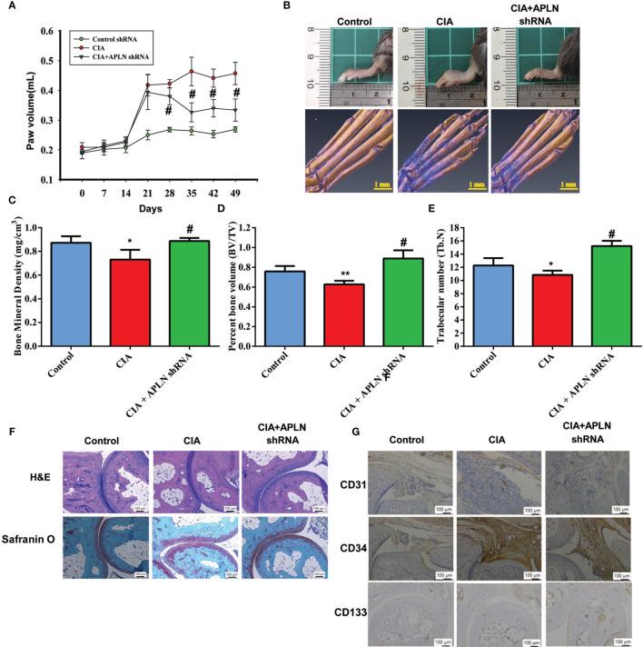 https://cdn.ncbi.nlm.nih.gov/pmc/blobs/a5e0/8511637/447aa5979fed/fimmu-12-737990-g006.jpg