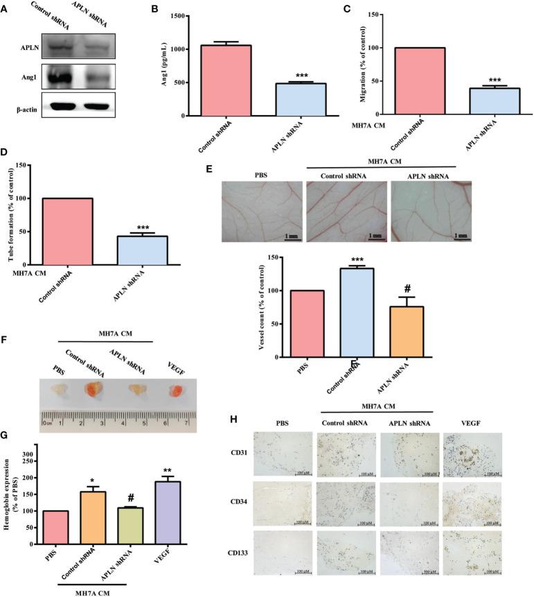 https://cdn.ncbi.nlm.nih.gov/pmc/blobs/a5e0/8511637/e9eb408e51f5/fimmu-12-737990-g005.jpg