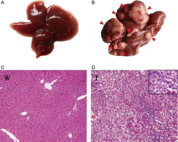 https://cdn.ncbi.nlm.nih.gov/pmc/blobs/a5e2/5633588/7d989da5fbc5/CAM4-6-2370-g001.jpg