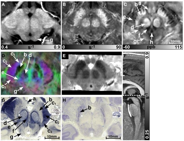 https://cdn.ncbi.nlm.nih.gov/pmc/blobs/a5e6/3810670/781e4e68ccc9/fnhum-07-00710-g001.jpg