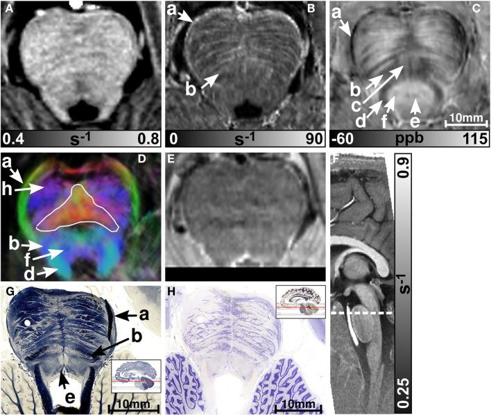 https://cdn.ncbi.nlm.nih.gov/pmc/blobs/a5e6/3810670/abe07d48c58c/fnhum-07-00710-g003.jpg