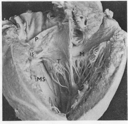 https://cdn.ncbi.nlm.nih.gov/pmc/blobs/a5e9/482106/205c5f72b004/brheartj00209-0024-a.jpg