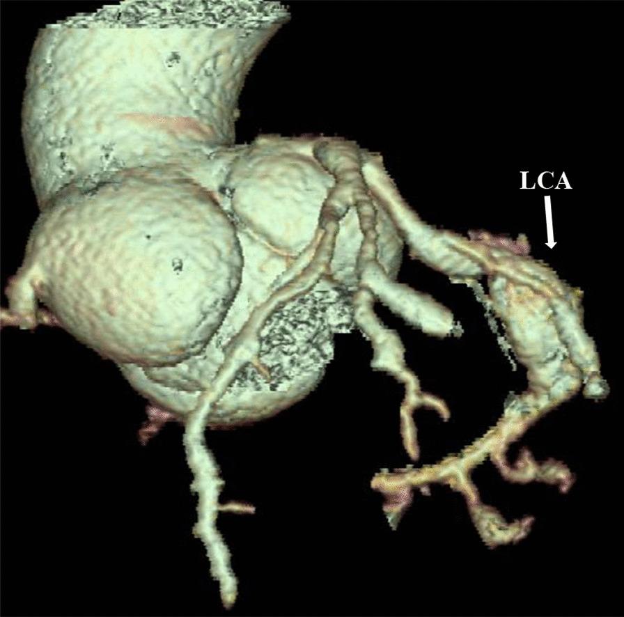 https://cdn.ncbi.nlm.nih.gov/pmc/blobs/a5e9/7845094/aab2ef00807f/13023_2021_1689_Fig1_HTML.jpg