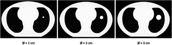 https://cdn.ncbi.nlm.nih.gov/pmc/blobs/a5f0/11244680/84e03901a83b/ACM2-25-e14311-g004.jpg