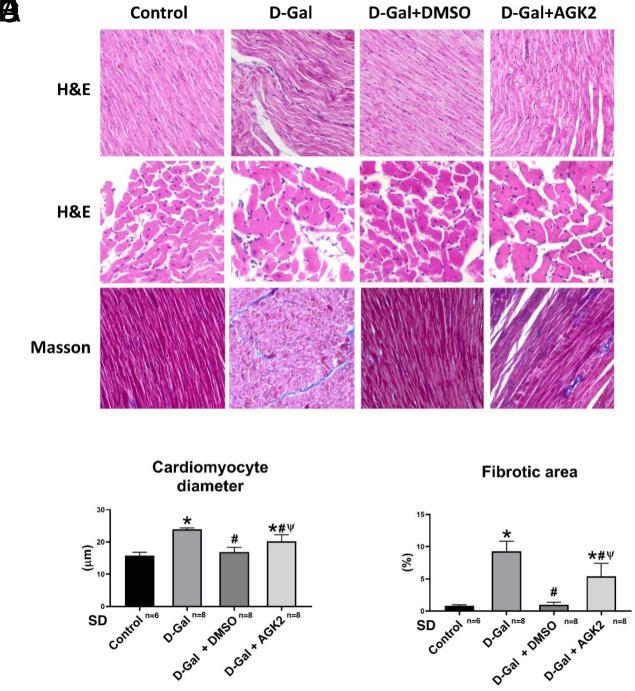 https://cdn.ncbi.nlm.nih.gov/pmc/blobs/a5f1/11965944/377486866b1c/ajc-29-4-173_f003.jpg
