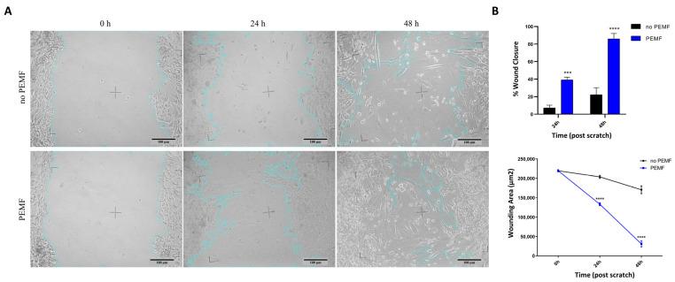 https://cdn.ncbi.nlm.nih.gov/pmc/blobs/a5f4/10706358/835bb1df4ac8/ijms-24-16631-g005.jpg