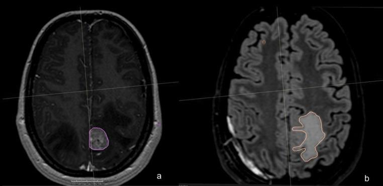 https://cdn.ncbi.nlm.nih.gov/pmc/blobs/a602/11615094/9e519cc6c130/11060_2024_4818_Fig1_HTML.jpg