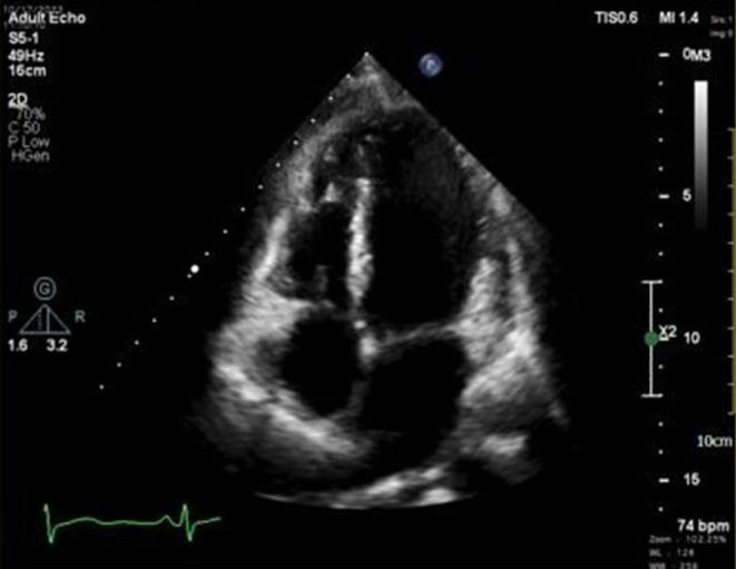 https://cdn.ncbi.nlm.nih.gov/pmc/blobs/a603/11303667/74b6be464b94/CCR3-12-e9207-g001.jpg