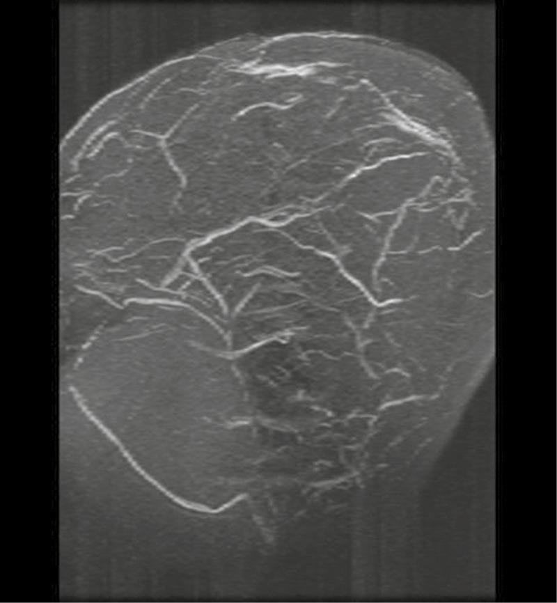 https://cdn.ncbi.nlm.nih.gov/pmc/blobs/a604/5890567/0da3d351fb79/JPN-12-389-g002.jpg