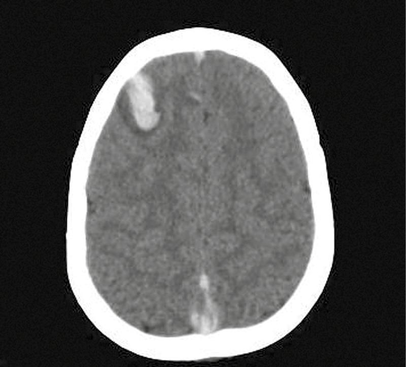 https://cdn.ncbi.nlm.nih.gov/pmc/blobs/a604/5890567/b50dc51d0941/JPN-12-389-g001.jpg