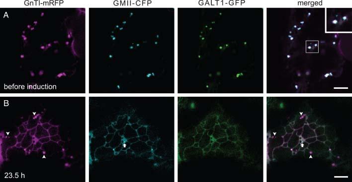 https://cdn.ncbi.nlm.nih.gov/pmc/blobs/a60a/3039244/ead5f2065450/tra0011-1429-f3.jpg