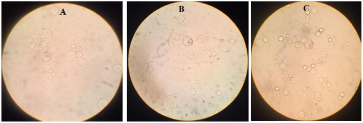 https://cdn.ncbi.nlm.nih.gov/pmc/blobs/a617/9404381/9419e929bbe0/fmed-09-940332-g0001.jpg