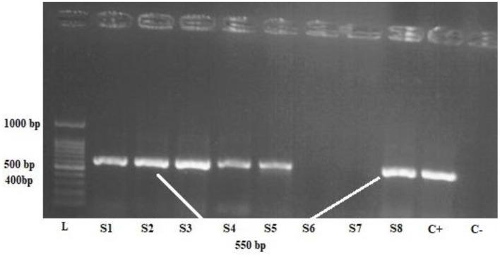 https://cdn.ncbi.nlm.nih.gov/pmc/blobs/a617/9404381/c834d8d94539/fmed-09-940332-g0002.jpg