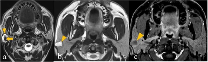 https://cdn.ncbi.nlm.nih.gov/pmc/blobs/a619/12175207/0003a280fffd/ARA-69-452-g005.jpg
