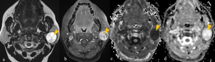 https://cdn.ncbi.nlm.nih.gov/pmc/blobs/a619/12175207/d7660c7b9764/ARA-69-452-g001.jpg