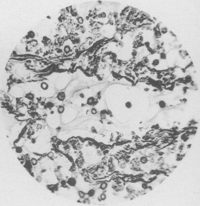 https://cdn.ncbi.nlm.nih.gov/pmc/blobs/a61c/2105997/cfaf393be245/jmedres00126-0053-c.jpg