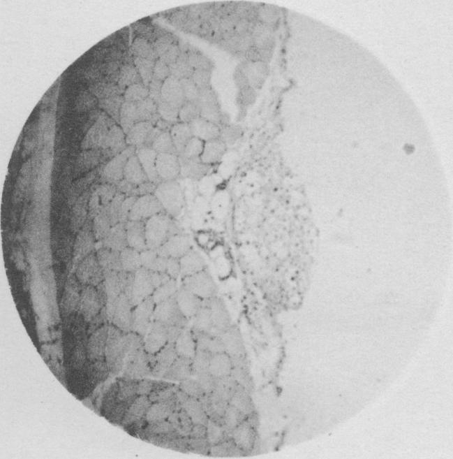 https://cdn.ncbi.nlm.nih.gov/pmc/blobs/a61c/2105997/e000fc121d83/jmedres00126-0054-d.jpg