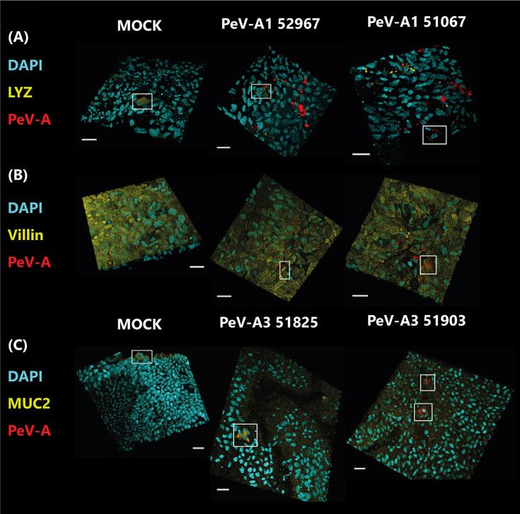 https://cdn.ncbi.nlm.nih.gov/pmc/blobs/a622/8591172/a6f25b212c23/fcimb-11-740662-g006.jpg