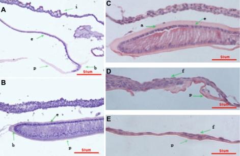 https://cdn.ncbi.nlm.nih.gov/pmc/blobs/a633/2834568/661998e200a0/mv-v16-341-f2.jpg