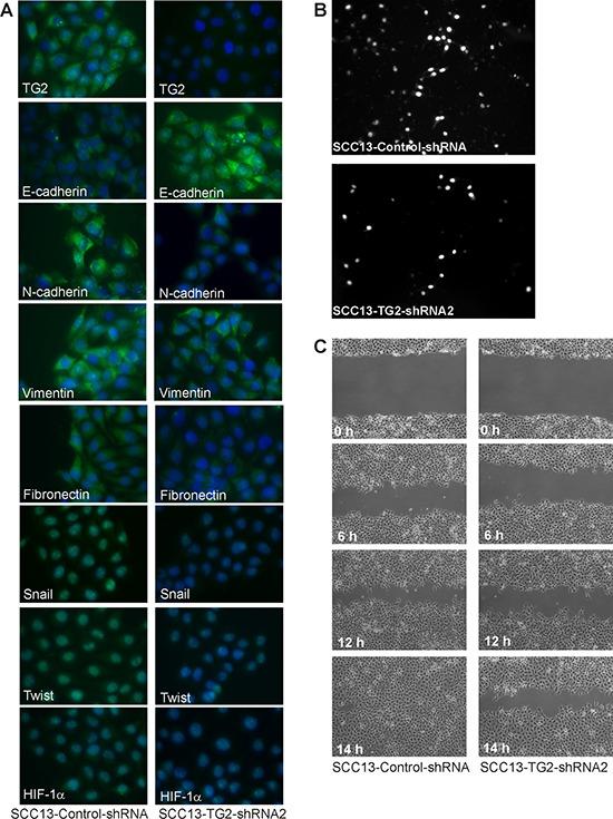 https://cdn.ncbi.nlm.nih.gov/pmc/blobs/a63a/4653023/6551c918de32/oncotarget-06-20525-g002.jpg