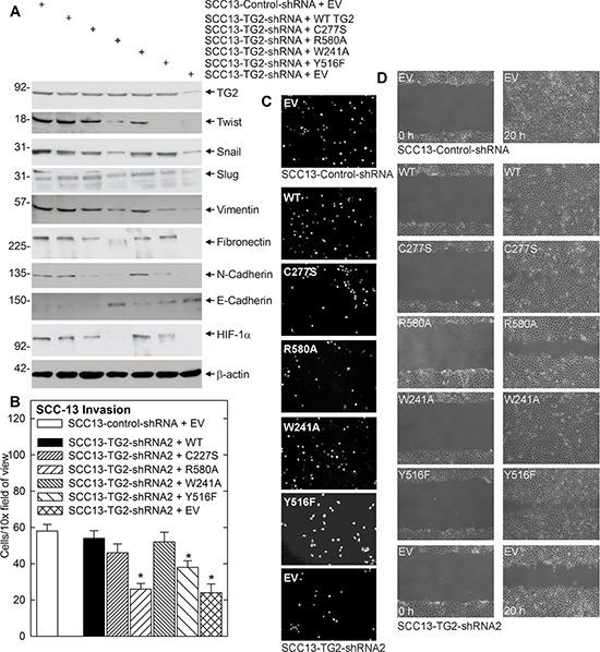 https://cdn.ncbi.nlm.nih.gov/pmc/blobs/a63a/4653023/854e13faa2b9/oncotarget-06-20525-g004.jpg