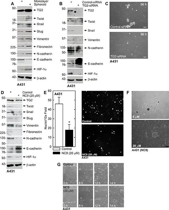 https://cdn.ncbi.nlm.nih.gov/pmc/blobs/a63a/4653023/8e1fbb7c0fbe/oncotarget-06-20525-g005.jpg